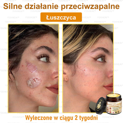 🎉💃🎉 Nie przegap! Do pół ceny taniej na wybrane produkty – tylko dziś! Przywróć swojej skórze sprężystość i młodzieńczy wygląd, którym zachwycisz otoczenie.