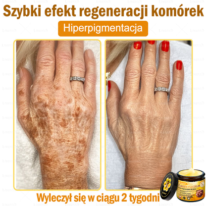 🎁💛🎁 Gratulacje! Dziś jesteś w gronie szczęśliwych klientów – otrzymujesz do 50% zniżki! Zadbaj o gładką, jędrną skórę i odzyskaj pewność siebie oraz urodę!