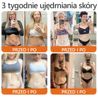 🎁💛🎁 Gratulacje! Dziś jesteś w gronie szczęśliwych klientów – otrzymujesz do 50% zniżki! Zadbaj o gładką, jędrną skórę i odzyskaj pewność siebie oraz urodę!