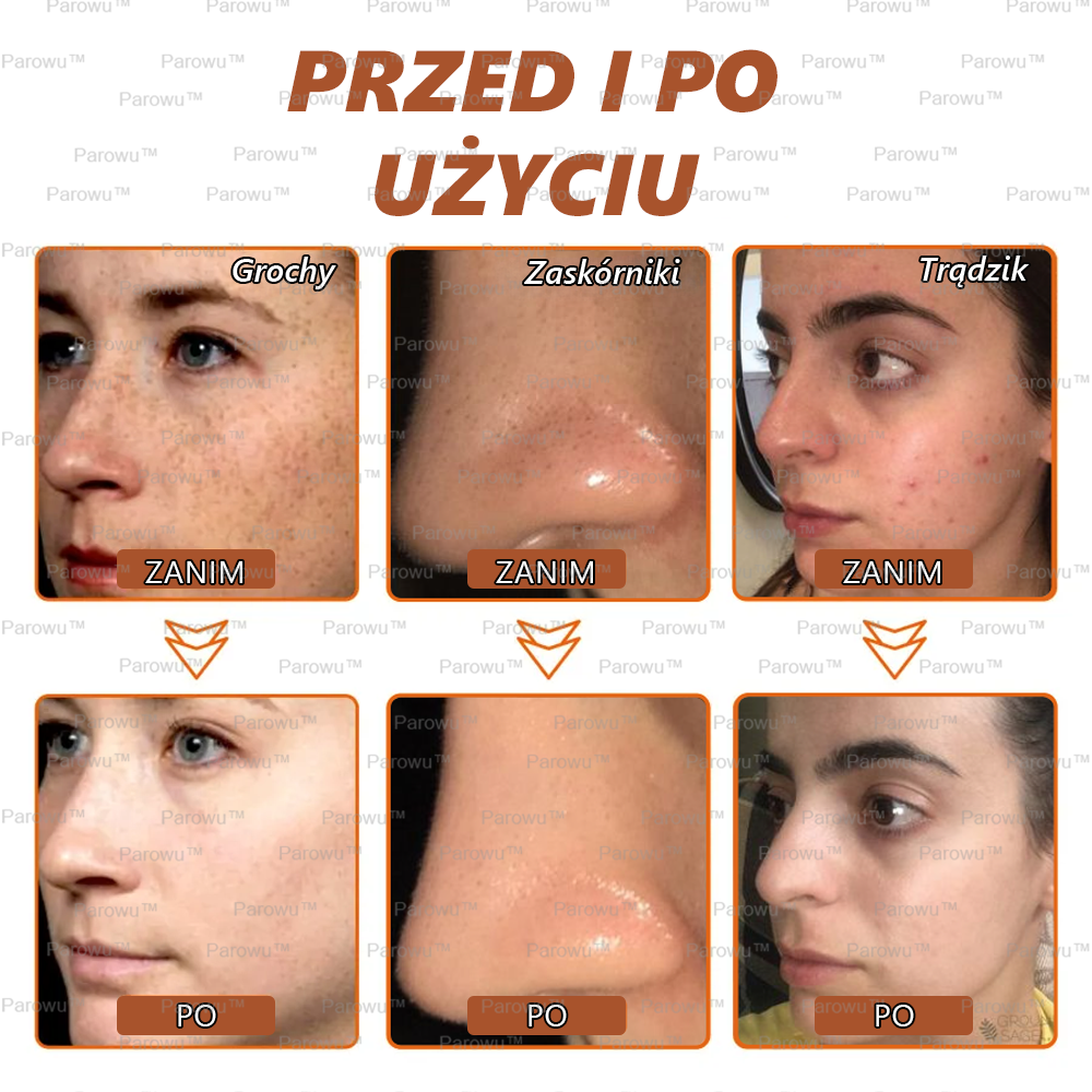 ✨🌙Parowu™ Wybielająca i Rozjaśniająca Maska - Naturalne składniki trwale usuwają plamy, piegi i przebarwienia