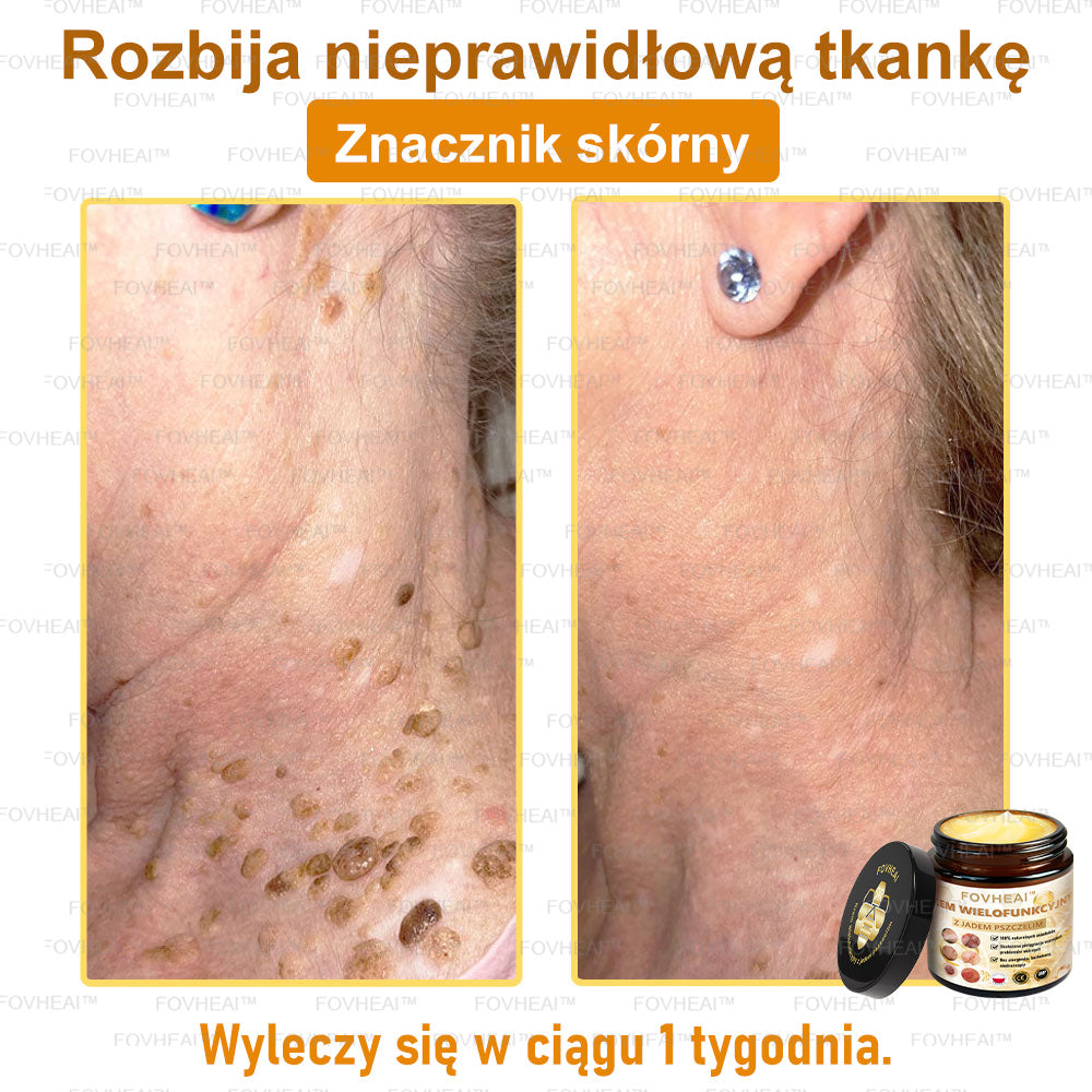 🎉💃🎉 Nie przegap! Do pół ceny taniej na wybrane produkty – tylko dziś! Przywróć swojej skórze sprężystość i młodzieńczy wygląd, którym zachwycisz otoczenie.