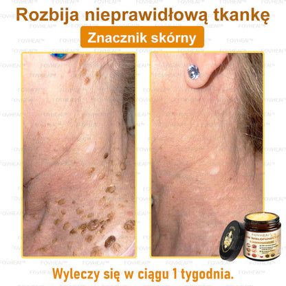 🎉💃🎉 Nie przegap! Do pół ceny taniej na wybrane produkty – tylko dziś! Przywróć swojej skórze sprężystość i młodzieńczy wygląd, którym zachwycisz otoczenie.