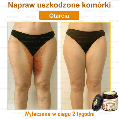 🎉💃🎉 Nie przegap! Do pół ceny taniej na wybrane produkty – tylko dziś! Przywróć swojej skórze sprężystość i młodzieńczy wygląd, którym zachwycisz otoczenie.