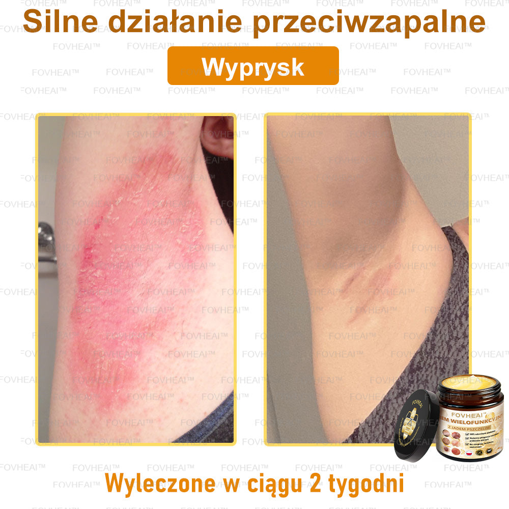 🎉💃🎉 Nie przegap! Do pół ceny taniej na wybrane produkty – tylko dziś! Przywróć swojej skórze sprężystość i młodzieńczy wygląd, którym zachwycisz otoczenie.