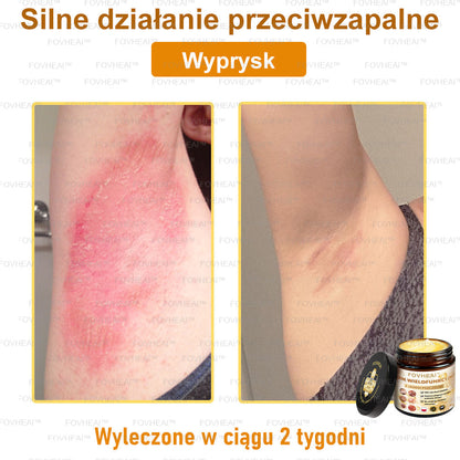 🎉💃🎉 Nie przegap! Do pół ceny taniej na wybrane produkty – tylko dziś! Przywróć swojej skórze sprężystość i młodzieńczy wygląd, którym zachwycisz otoczenie.