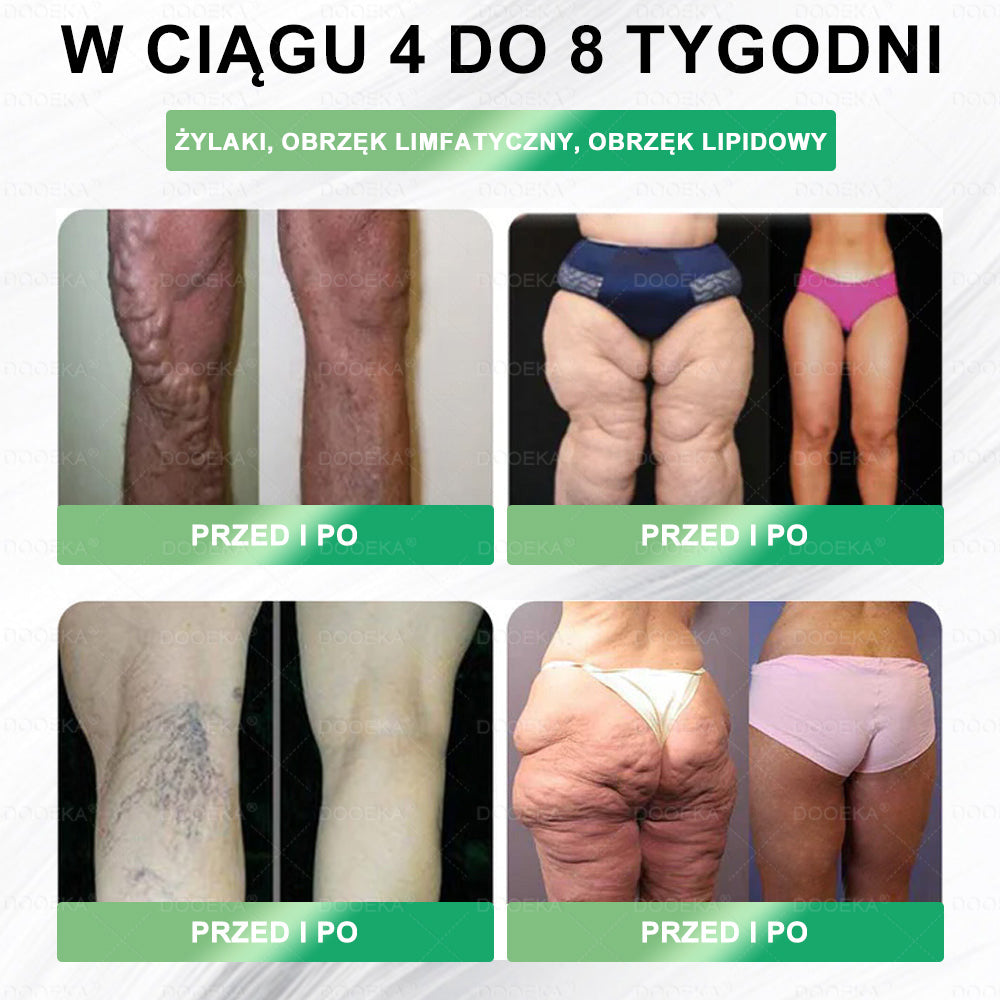 🌿✨🌿Gratulacje! Dziś dołączasz do grona szczęśliwych klientów – otrzymujesz aż do 50% zniżki! Zadbaj o lekki metabolizm, kontrolę apetytu i odzyskaj energię oraz pewność siebie każdego dnia!