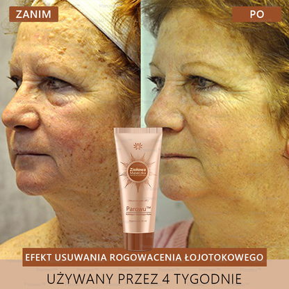 ✨🌙Parowu™ Wybielająca i Rozjaśniająca Maska - Naturalne składniki trwale usuwają plamy, piegi i przebarwienia