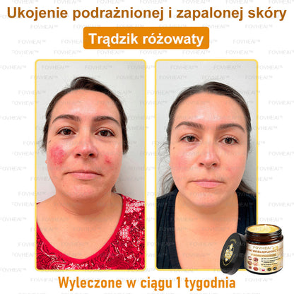 🎉💃🎉 Nie przegap! Do pół ceny taniej na wybrane produkty – tylko dziś! Przywróć swojej skórze sprężystość i młodzieńczy wygląd, którym zachwycisz otoczenie.
