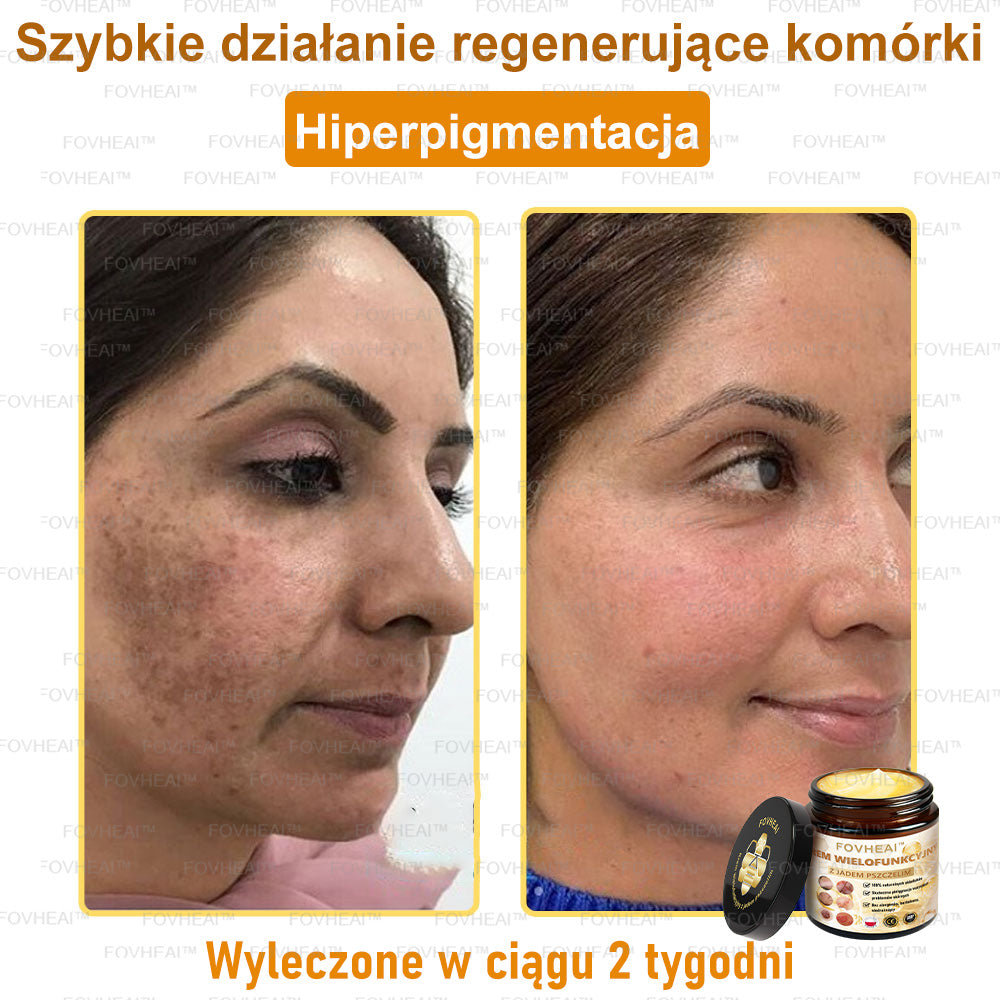 🎉💃🎉 Nie przegap! Do pół ceny taniej na wybrane produkty – tylko dziś! Przywróć swojej skórze sprężystość i młodzieńczy wygląd, którym zachwycisz otoczenie.