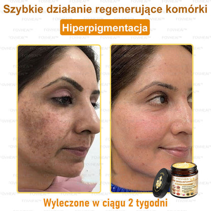 🎉💃🎉 Nie przegap! Do pół ceny taniej na wybrane produkty – tylko dziś! Przywróć swojej skórze sprężystość i młodzieńczy wygląd, którym zachwycisz otoczenie.