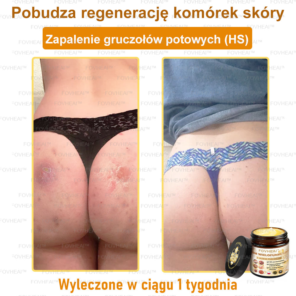 🎉💃🎉 Nie przegap! Do pół ceny taniej na wybrane produkty – tylko dziś! Przywróć swojej skórze sprężystość i młodzieńczy wygląd, którym zachwycisz otoczenie.