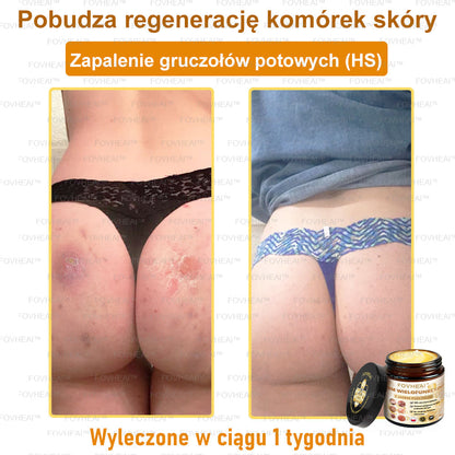 🎉💃🎉 Nie przegap! Do pół ceny taniej na wybrane produkty – tylko dziś! Przywróć swojej skórze sprężystość i młodzieńczy wygląd, którym zachwycisz otoczenie.
