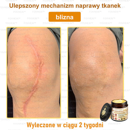🎉💃🎉 Nie przegap! Do pół ceny taniej na wybrane produkty – tylko dziś! Przywróć swojej skórze sprężystość i młodzieńczy wygląd, którym zachwycisz otoczenie.